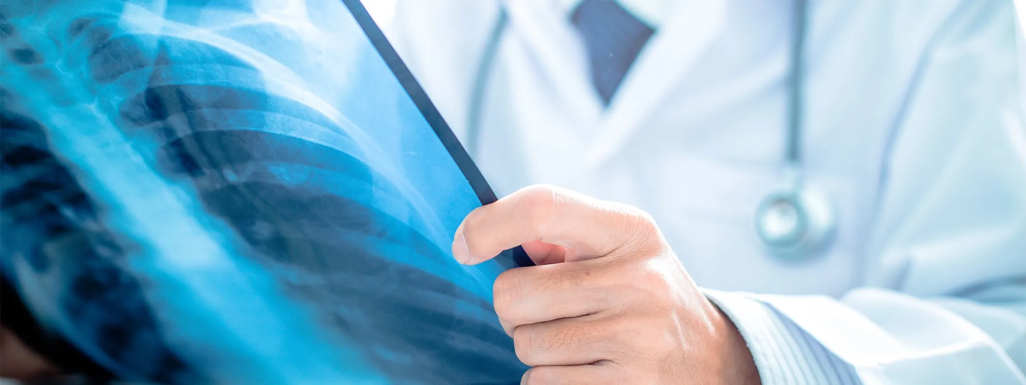 Radiologie Aalter - Radiologisch centrum voor echografie, mammografie en röntgen in 9880 Aalter
